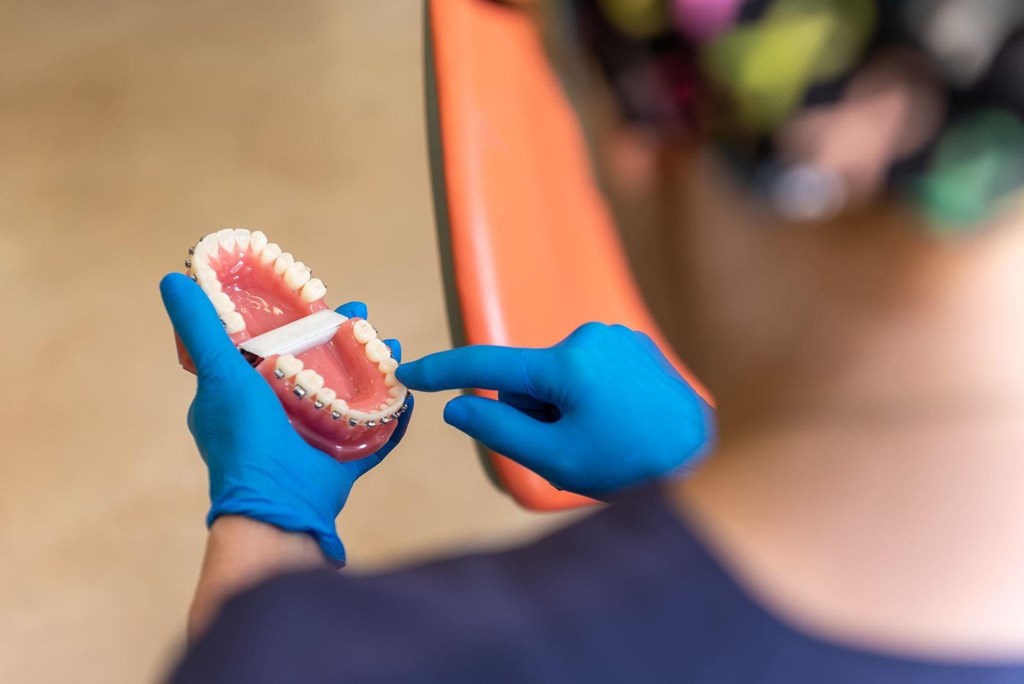 5 señales de que necesita ortodoncia, aunque ya no sea adolescente