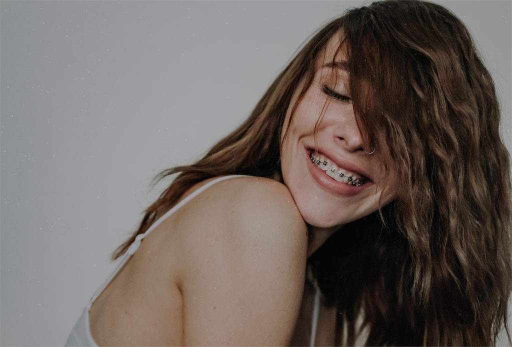 ¿Cómo cambian la vida los brackets?