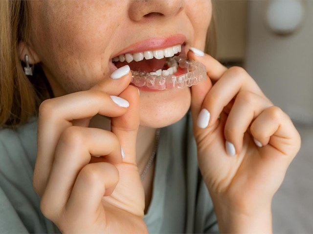 ¿Cuáles son los beneficios psicológicos de usar ortodoncia a una edad adulta?