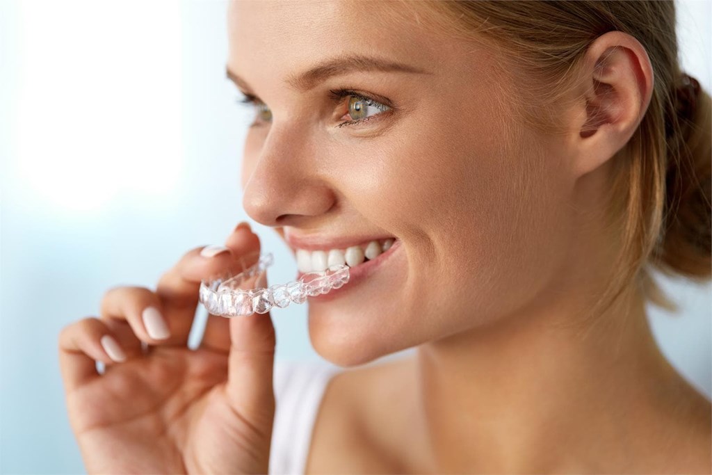 ¿Cuándo se comienza a notar el movimiento de los dientes con una ortodoncia?