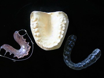  ¿Cuántos tipos de ortodoncia existen?