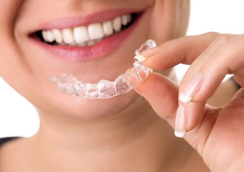 Diferencias entre Invisalign y los brackets