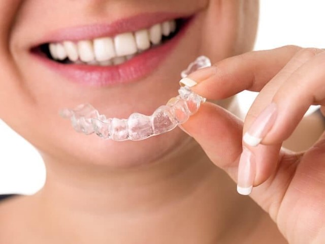 Diferencias entre Invisalign y los brackets