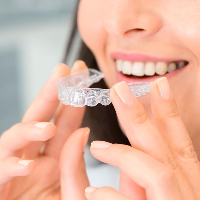 ¿El Invisalign es apto para los niños?