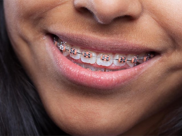 ¿En qué consiste un estudio de ortodoncia?
