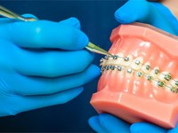 ¿Es normal llevar ortodoncia en diferentes épocas de la vida?