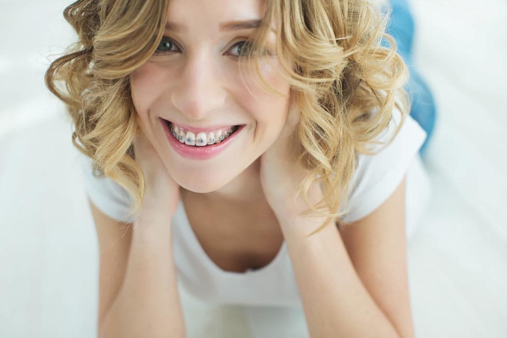 La eficacia de los brackets tradicionales