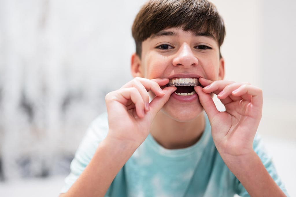 Invisalign