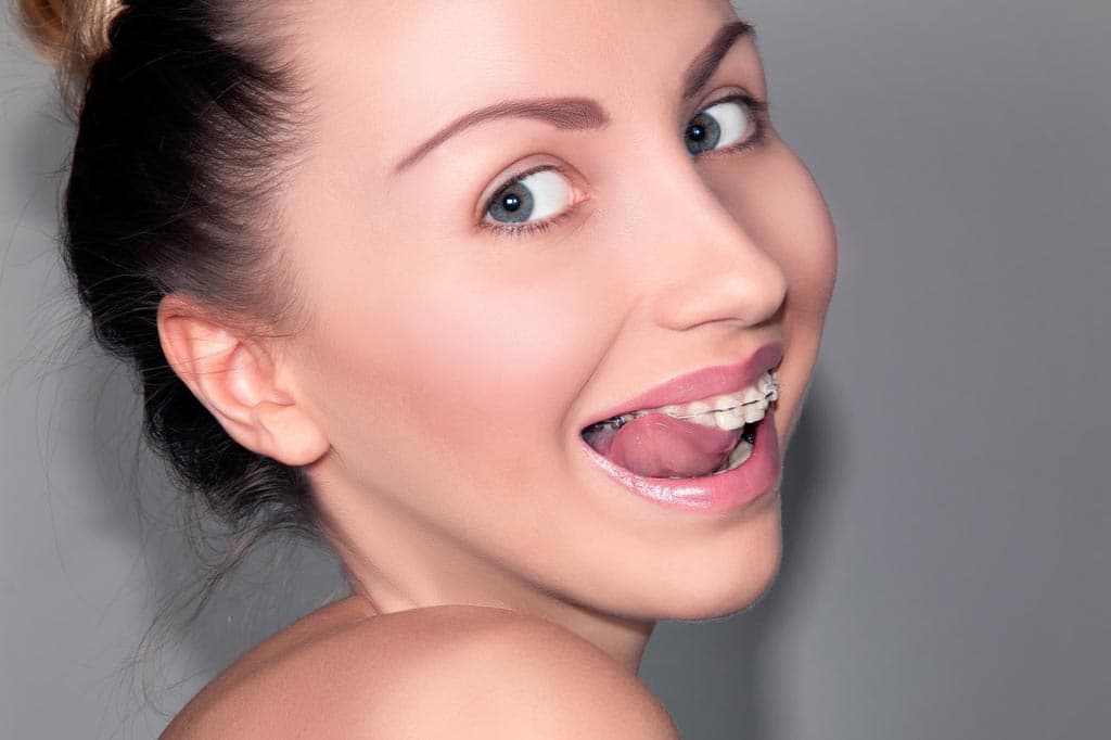 Mejore su sonrisa y su perfil facial con Damon System