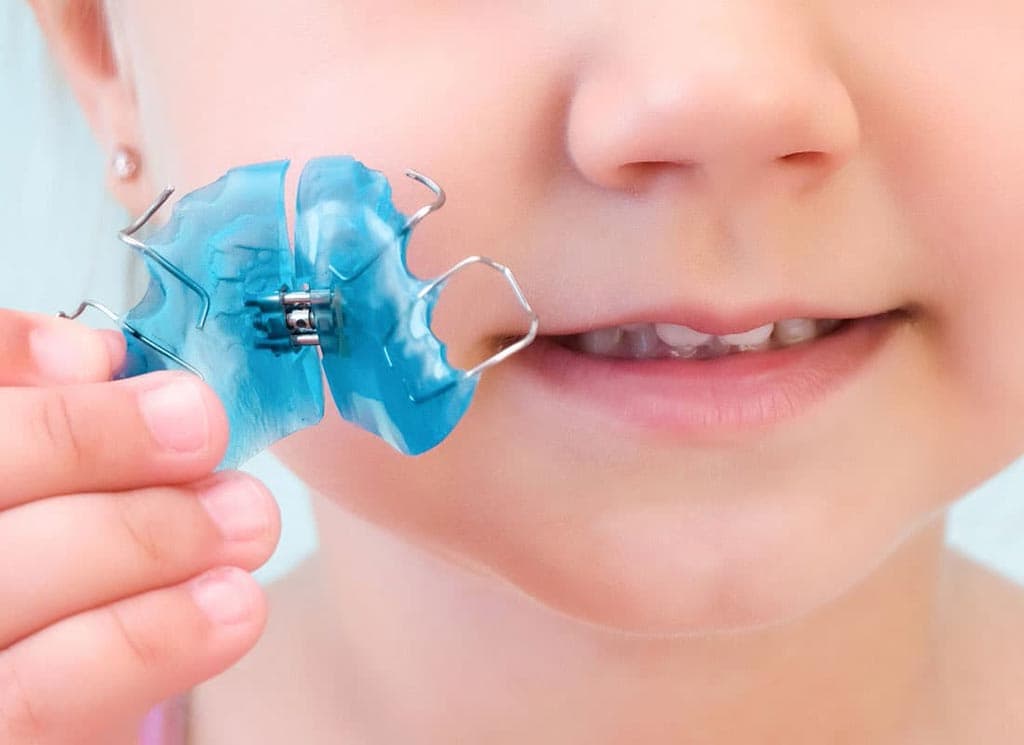 Ortodoncia para niños
