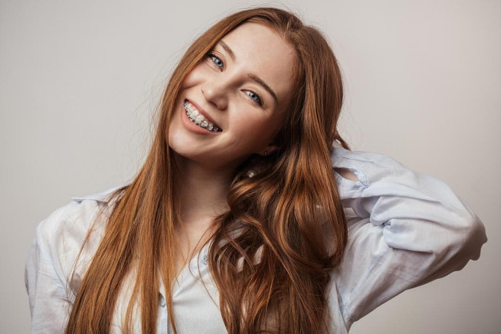 ¿Qué son los brackets estéticos?