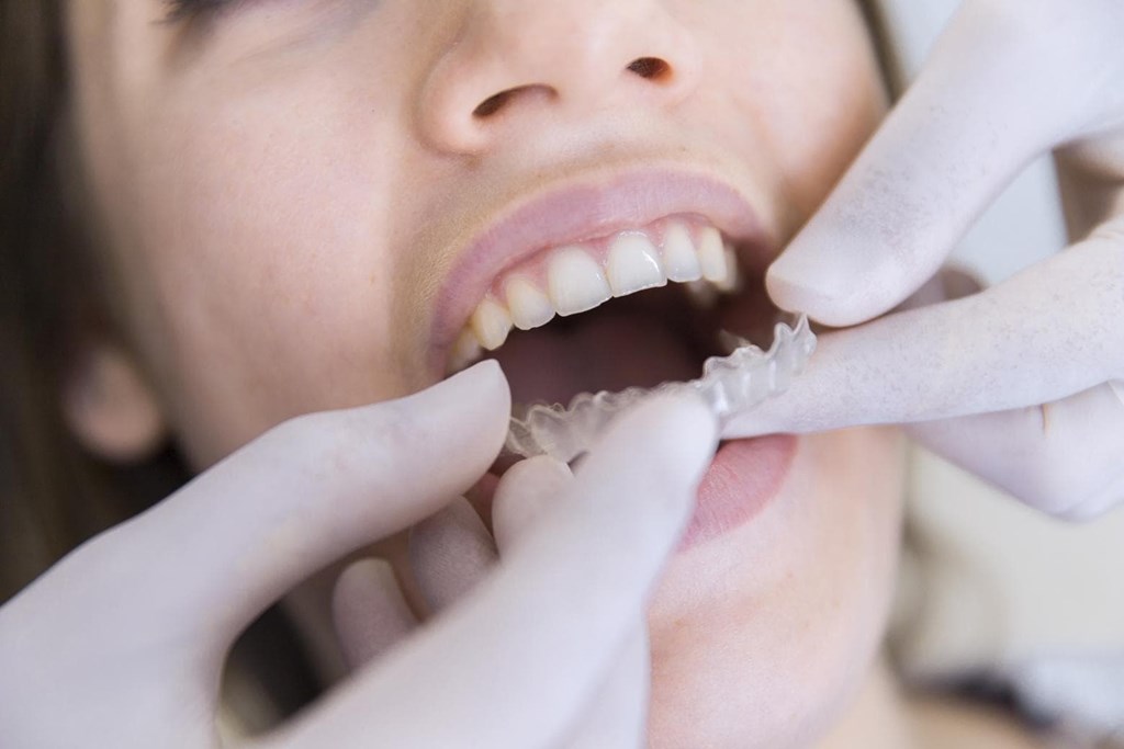 ¿Necesita un tratamiento de ortodoncia pero no se atreve a utilizarlo?