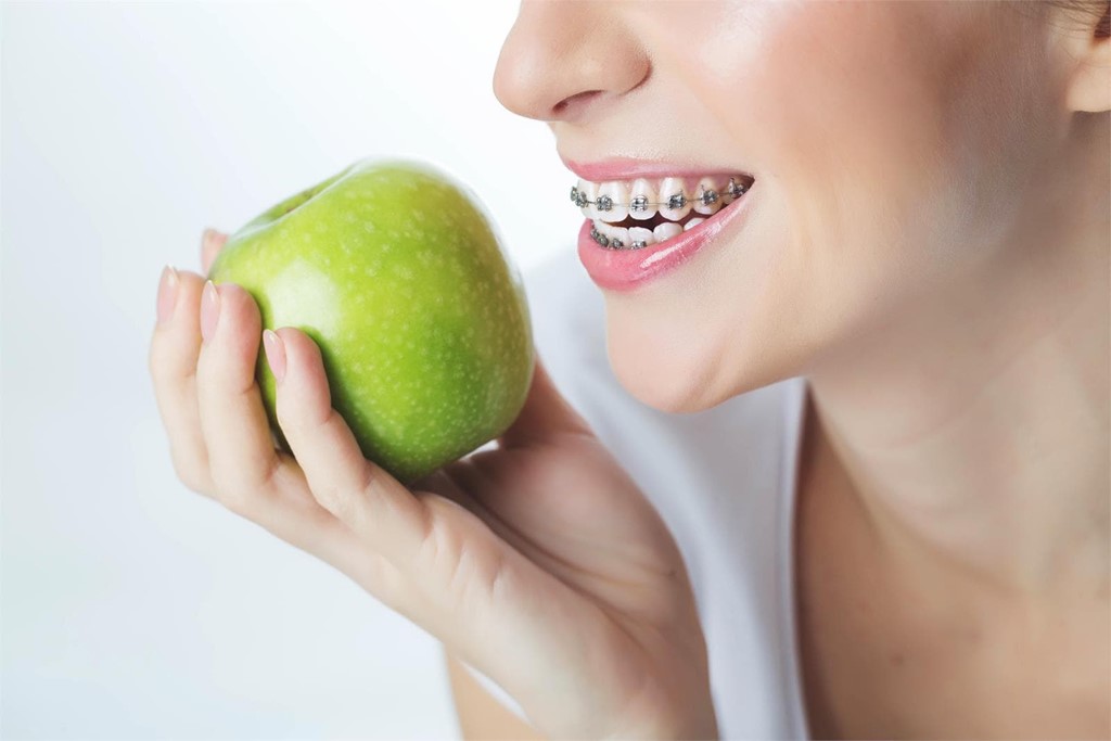 ¿Qué puedo comer con brackets?