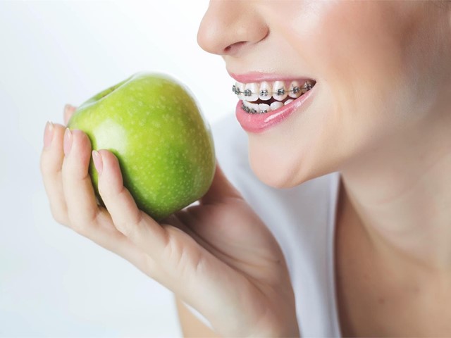 ¿Qué puedo comer con brackets?