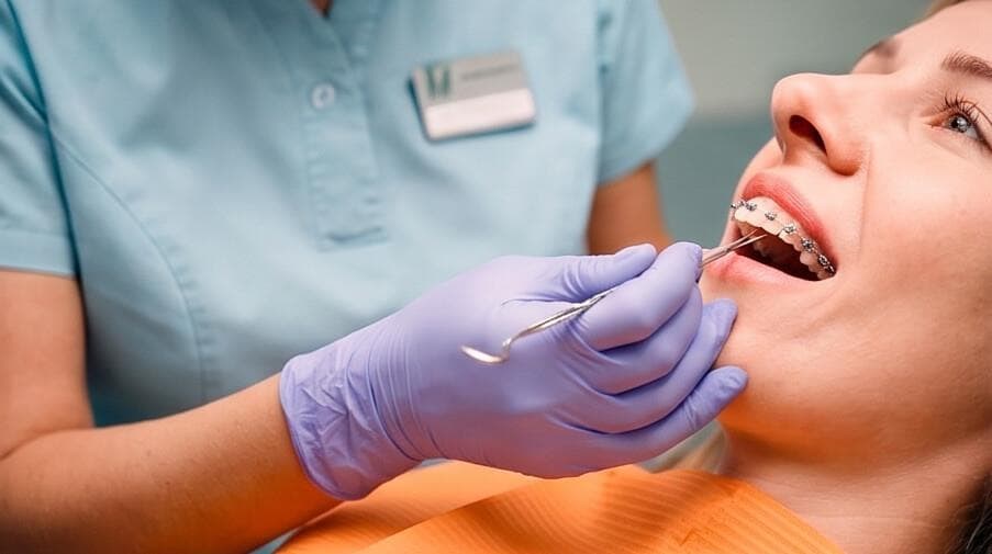 ¿Qué son los brackets de autoligado y en qué se diferencian de los tradicionales?
