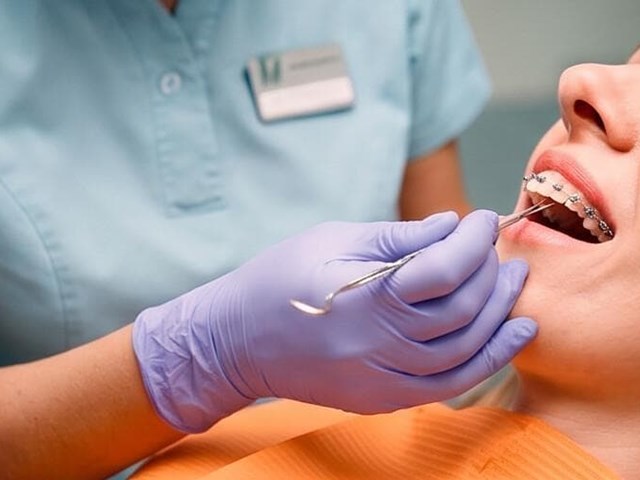 ¿Qué son los brackets de autoligado y en qué se diferencian de los tradicionales?